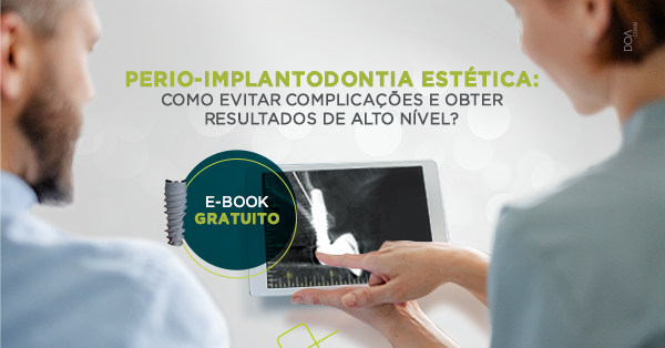 Recessões gengivais unitárias, como tratar?