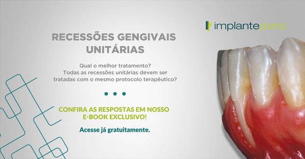 Recessões gengivais unitárias, como tratar?